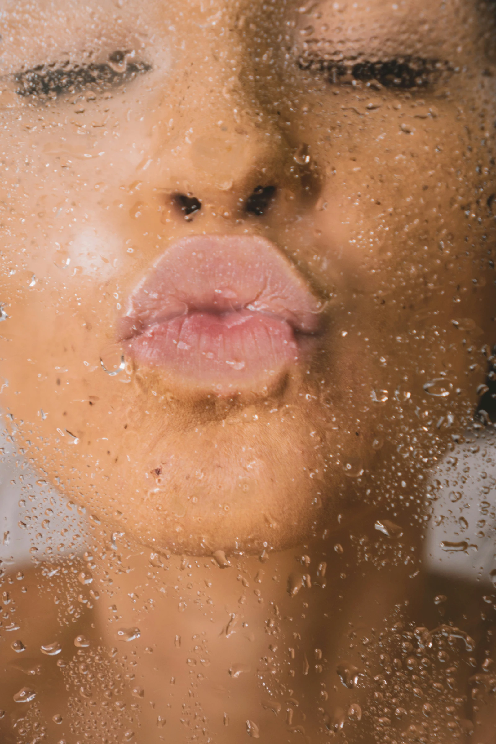 Hyaluronic acid dermal fillers and Profhilo hydration