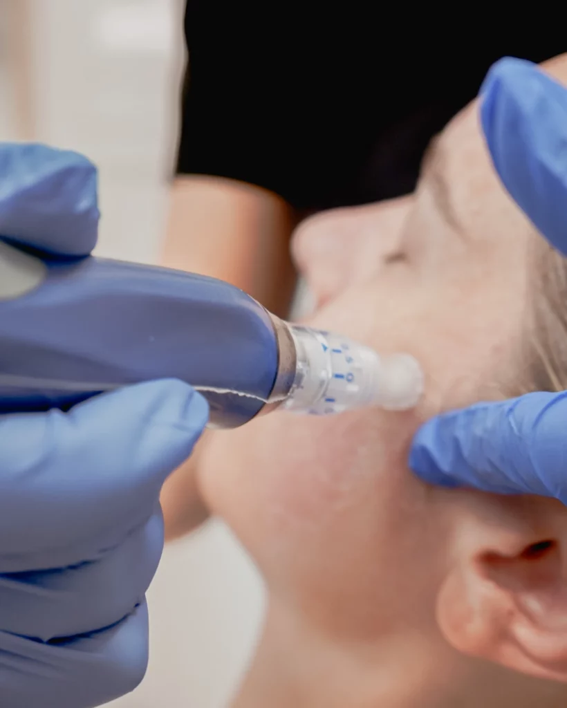 Masseter botox for jaw clenching and facial slimming